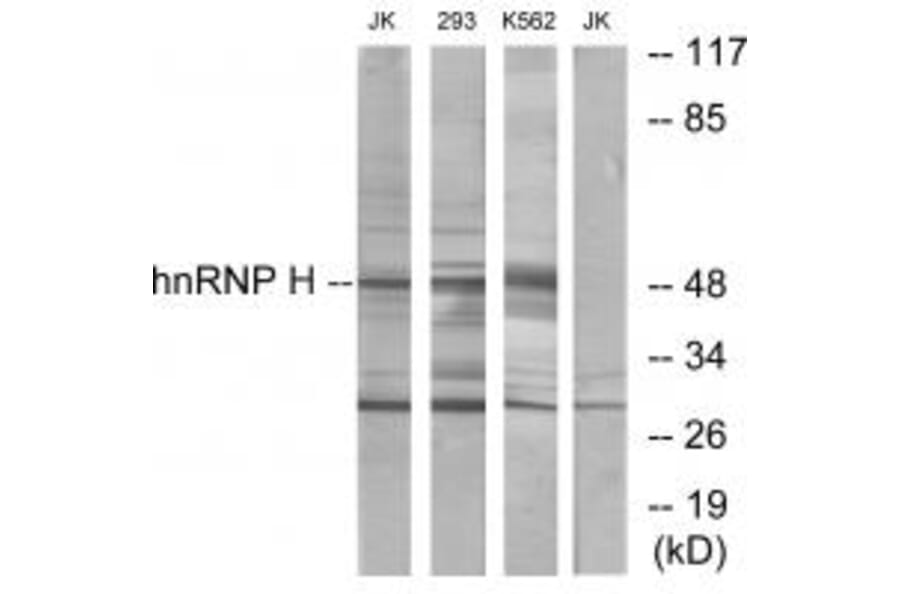 Western blot - hnRNP H Antibody from Signalway Antibody (33824) - Antibodies.com