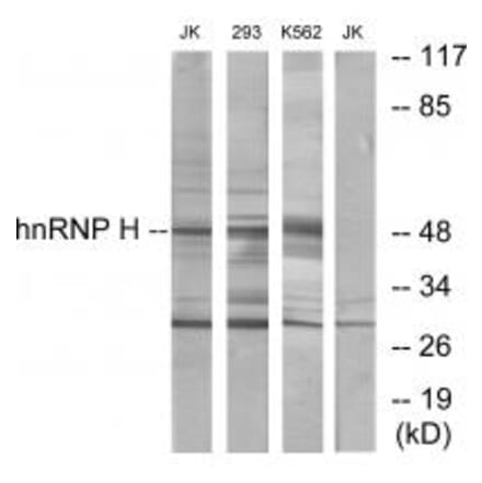 Western blot - hnRNP H Antibody from Signalway Antibody (33824) - Antibodies.com