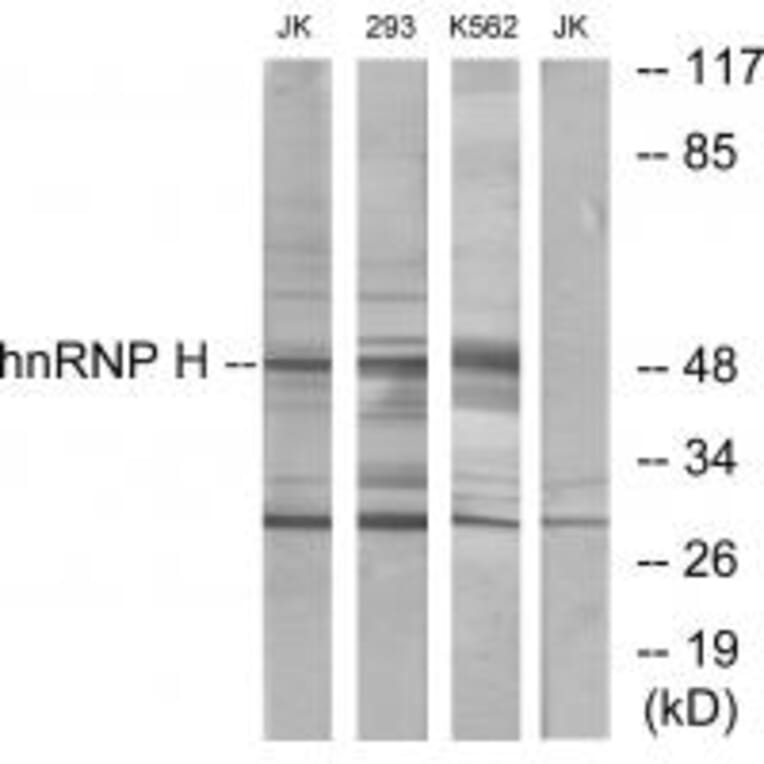 Western blot - hnRNP H Antibody from Signalway Antibody (33824) - Antibodies.com