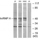 Western blot - hnRNP H Antibody from Signalway Antibody (33824) - Antibodies.com