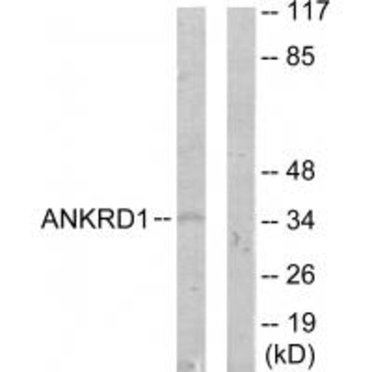 Western blot - ANKRD1 Antibody from Signalway Antibody (33895) - Antibodies.com