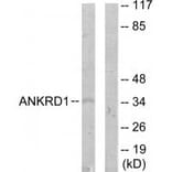 Western blot - ANKRD1 Antibody from Signalway Antibody (33895) - Antibodies.com