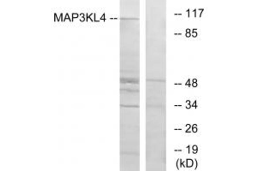 Western blot - MAP3KL4 Antibody from Signalway Antibody (33930) - Antibodies.com