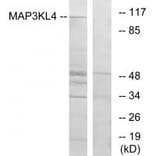 Western blot - MAP3KL4 Antibody from Signalway Antibody (33930) - Antibodies.com