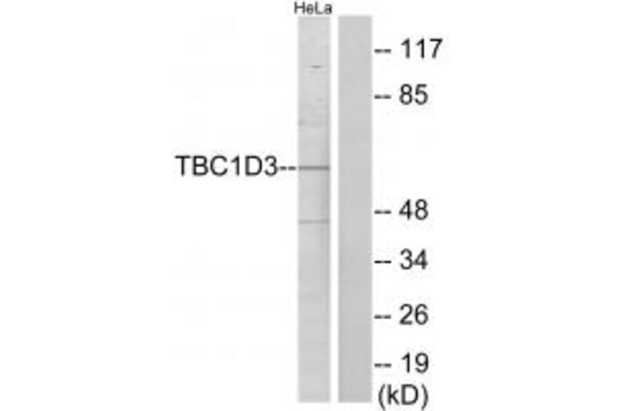 Western blot - TBC1D3 Antibody from Signalway Antibody (33964) - Antibodies.com