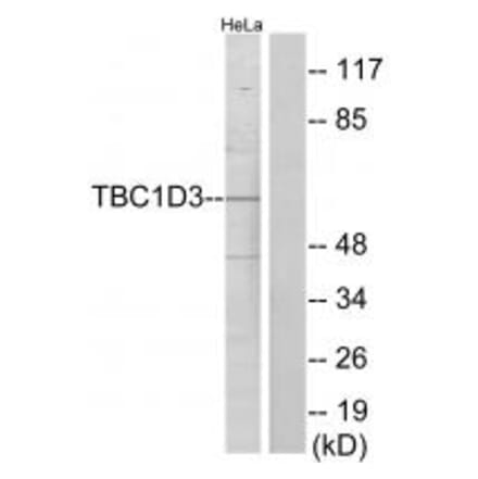 Western blot - TBC1D3 Antibody from Signalway Antibody (33964) - Antibodies.com
