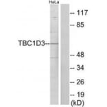 Western blot - TBC1D3 Antibody from Signalway Antibody (33964) - Antibodies.com