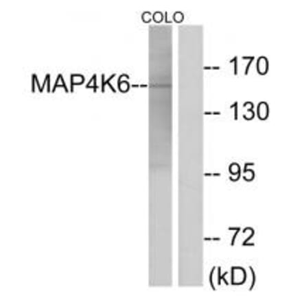 Western blot - MAP4K6 Antibody from Signalway Antibody (33966) - Antibodies.com