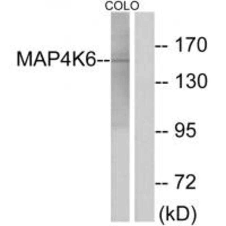 Western blot - MAP4K6 Antibody from Signalway Antibody (33966) - Antibodies.com