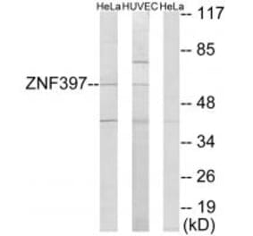Western blot - ZNF397 Antibody from Signalway Antibody (33976) - Antibodies.com
