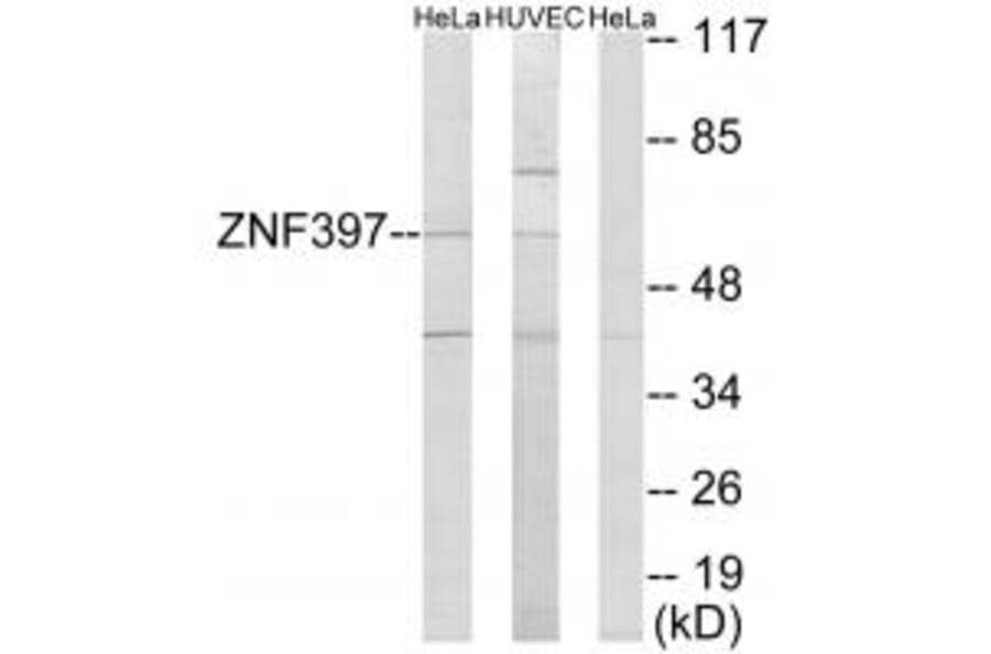 Western blot - ZNF397 Antibody from Signalway Antibody (33976) - Antibodies.com
