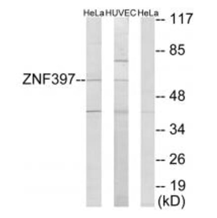 Western blot - ZNF397 Antibody from Signalway Antibody (33976) - Antibodies.com