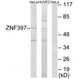 Western blot - ZNF397 Antibody from Signalway Antibody (33976) - Antibodies.com