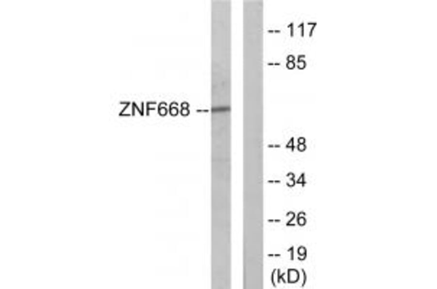 Western blot - ZNF668 Antibody from Signalway Antibody (34031) - Antibodies.com