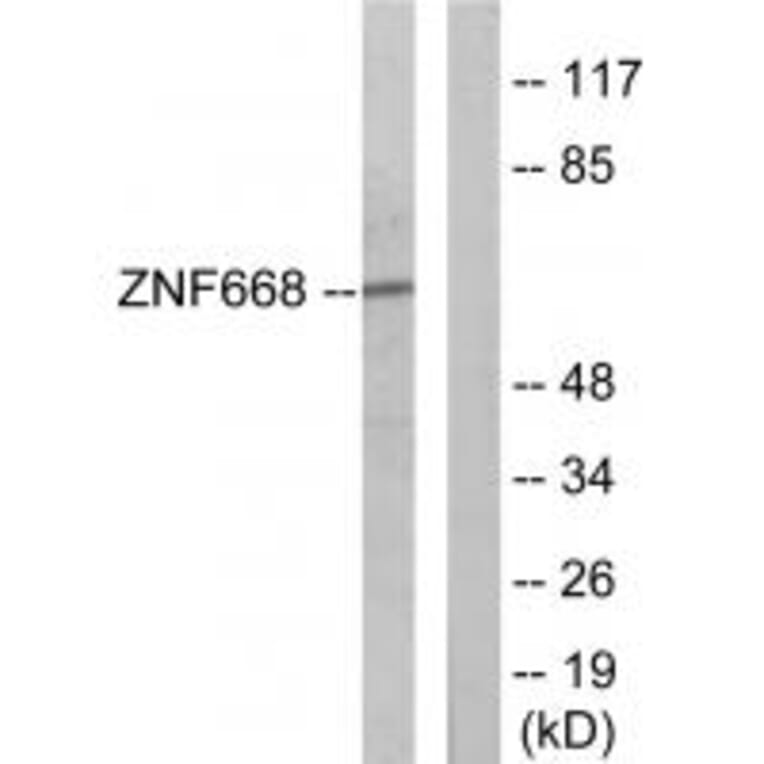 Western blot - ZNF668 Antibody from Signalway Antibody (34031) - Antibodies.com
