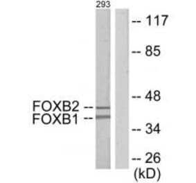 Western blot - FOXB1/2 Antibody from Signalway Antibody (34037) - Antibodies.com