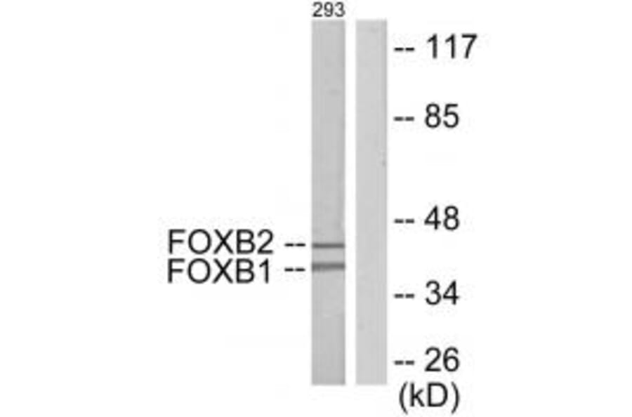 Western blot - FOXB1/2 Antibody from Signalway Antibody (34037) - Antibodies.com