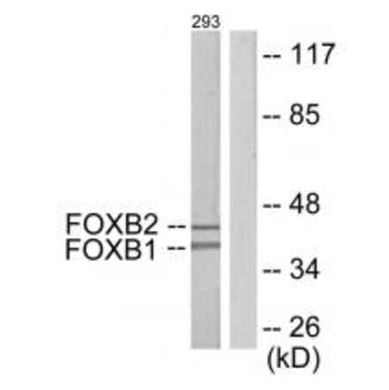 Western blot - FOXB1/2 Antibody from Signalway Antibody (34037) - Antibodies.com