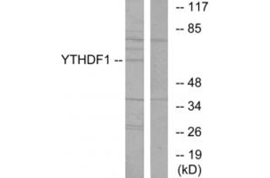 Western blot - YTHDF1 Antibody from Signalway Antibody (34050) - Antibodies.com