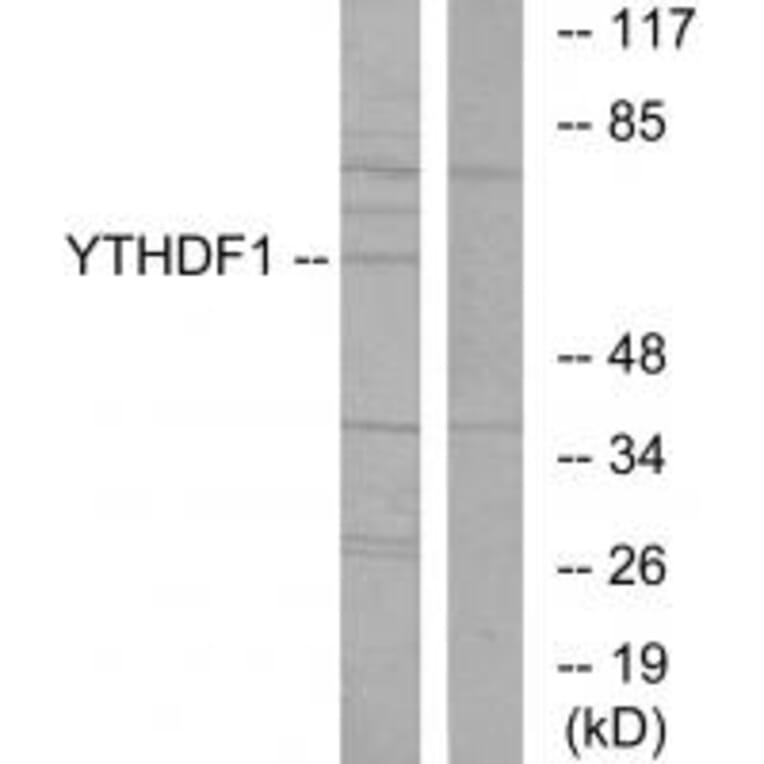 Western blot - YTHDF1 Antibody from Signalway Antibody (34050) - Antibodies.com