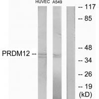 Western blot analysis of extracts from HUVEC cells and A549 cells, using PRDM12 antibody #34063.
