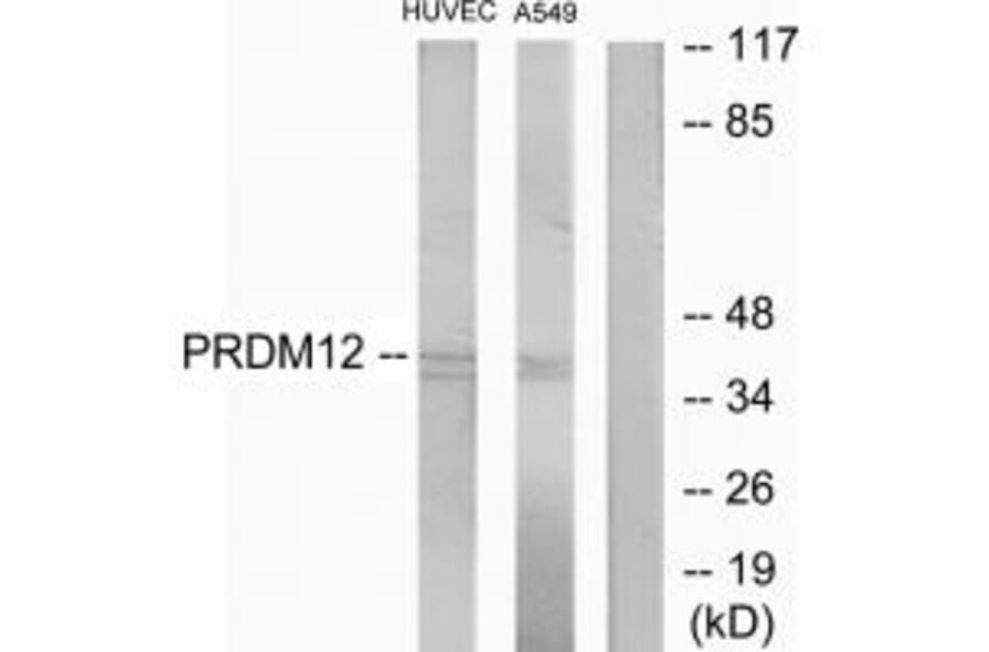 Western blot - PRDM12 Antibody from Signalway Antibody (34063) - Antibodies.com