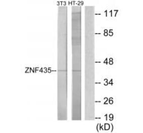 Western blot - ZNF435 Antibody from Signalway Antibody (34064) - Antibodies.com