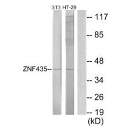 Western blot - ZNF435 Antibody from Signalway Antibody (34064) - Antibodies.com