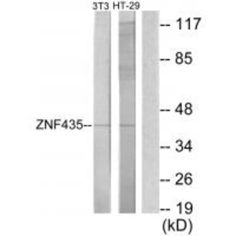 Western blot - ZNF435 Antibody from Signalway Antibody (34064) - Antibodies.com