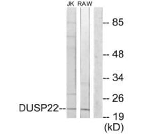 Western blot - DUSP22 Antibody from Signalway Antibody (34076) - Antibodies.com