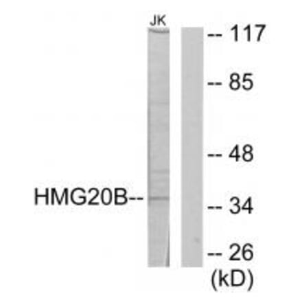 Western blot - HMG20B Antibody from Signalway Antibody (34088) - Antibodies.com
