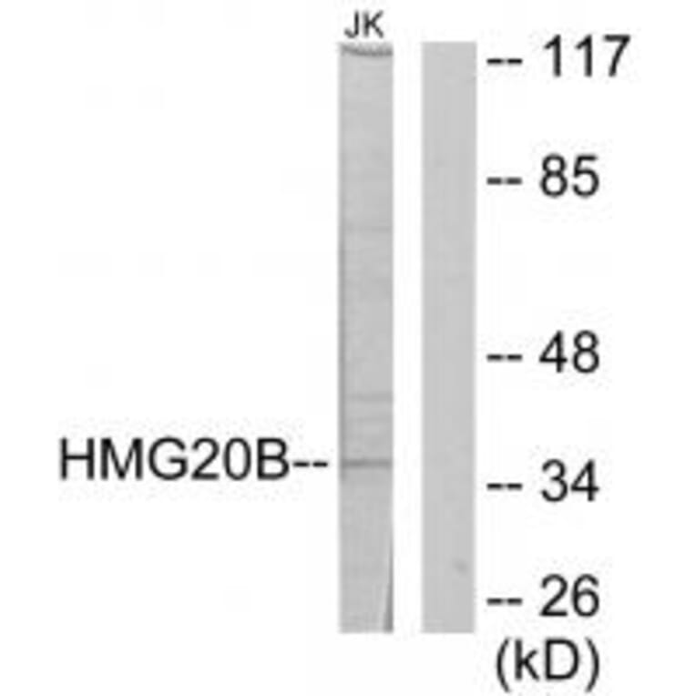 Western blot - HMG20B Antibody from Signalway Antibody (34088) - Antibodies.com