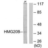Western blot - HMG20B Antibody from Signalway Antibody (34088) - Antibodies.com