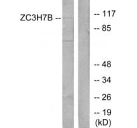 Western blot - ZC3H7B Antibody from Signalway Antibody (34099) - Antibodies.com