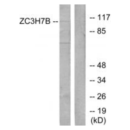 Western blot - ZC3H7B Antibody from Signalway Antibody (34099) - Antibodies.com