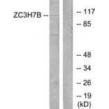 Western blot - ZC3H7B Antibody from Signalway Antibody (34099) - Antibodies.com