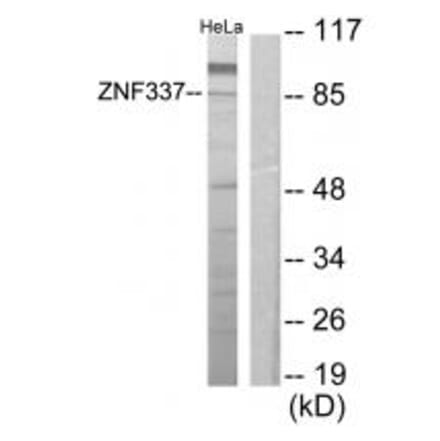 Western blot - ZNF337 Antibody from Signalway Antibody (34133) - Antibodies.com