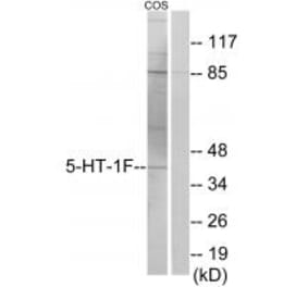 Western blot - 5-HT-1F Antibody from Signalway Antibody (34150) - Antibodies.com