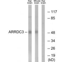 Western blot - ARRDC3 Antibody from Signalway Antibody (34169) - Antibodies.com