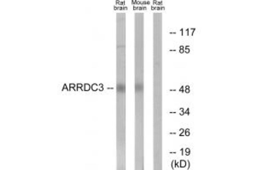 Western blot - ARRDC3 Antibody from Signalway Antibody (34169) - Antibodies.com