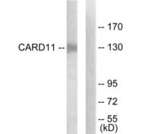 Western blot - CARD11 Antibody from Signalway Antibody (34184) - Antibodies.com