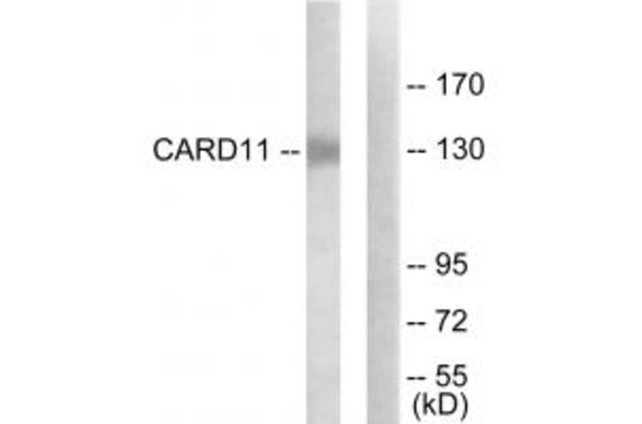 Western blot - CARD11 Antibody from Signalway Antibody (34184) - Antibodies.com
