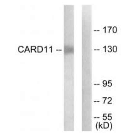 Western blot - CARD11 Antibody from Signalway Antibody (34184) - Antibodies.com