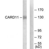 Western blot - CARD11 Antibody from Signalway Antibody (34184) - Antibodies.com
