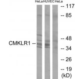 Western blot - CMKLR1 Antibody from Signalway Antibody (34201) - Antibodies.com