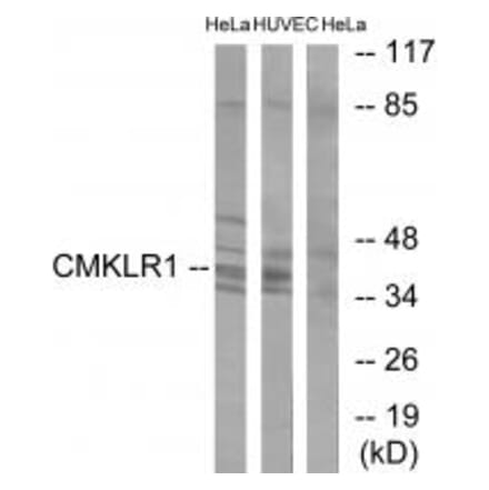 Western blot - CMKLR1 Antibody from Signalway Antibody (34201) - Antibodies.com