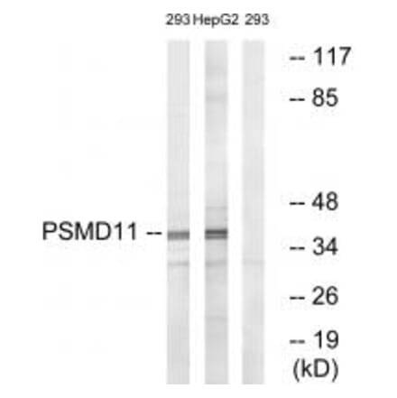Western blot - PSMD11 Antibody from Signalway Antibody (34307) - Antibodies.com