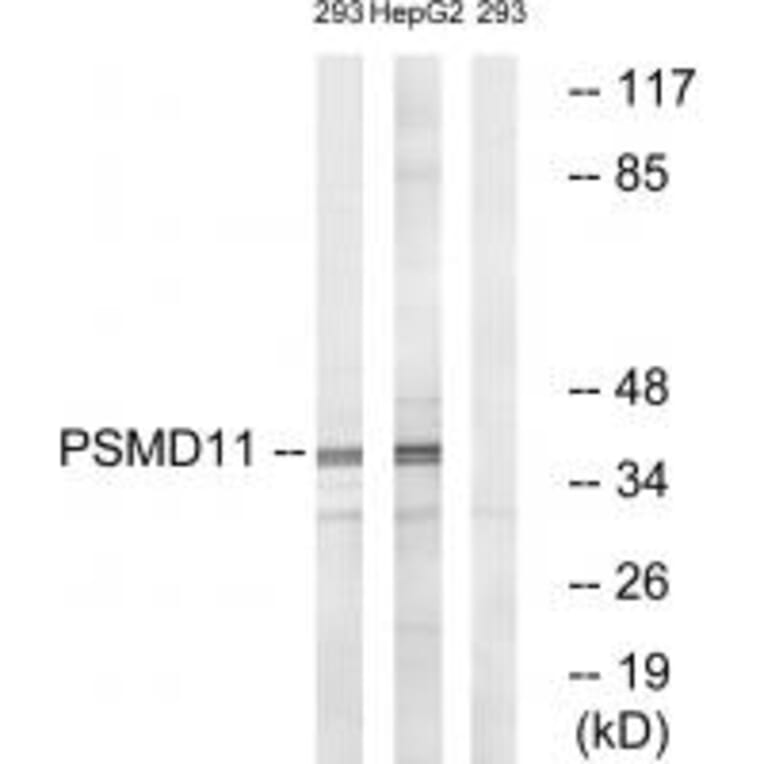 Western blot - PSMD11 Antibody from Signalway Antibody (34307) - Antibodies.com