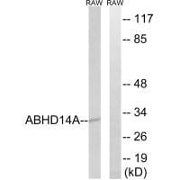 Western blot analysis of extracts from RAW264.7 cells, using ABHD14A antibody #34368.