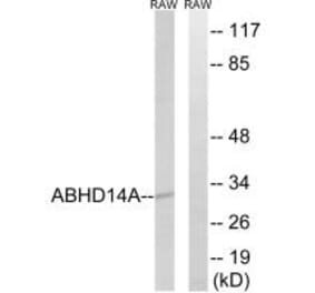 Western blot - ABHD14A Antibody from Signalway Antibody (34368) - Antibodies.com